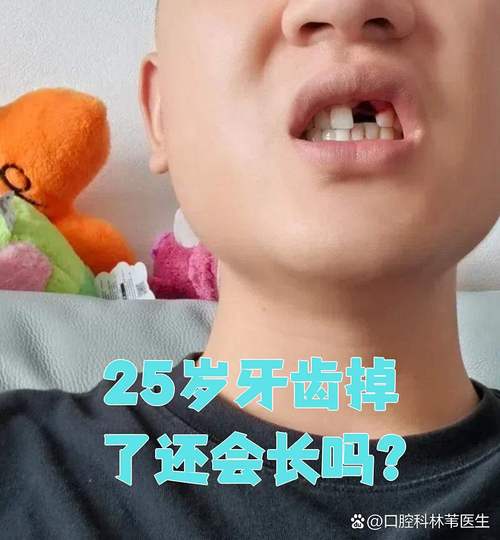 牙脱了可种回去吗-图2 牙脱了可种回去吗-图2