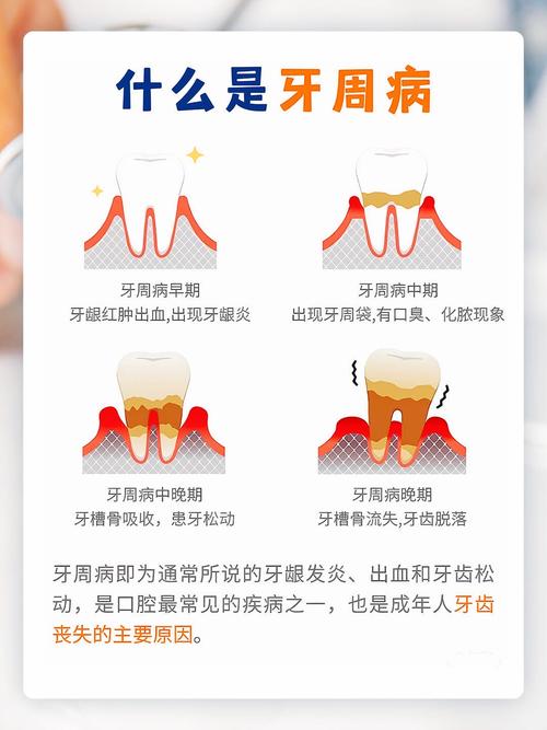 牙周病的保健方法-图1
