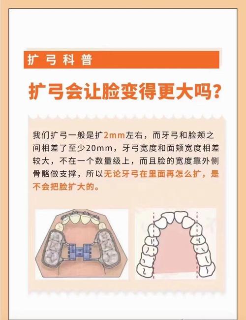 正畸面弓如何正确佩戴？操作步骤有哪些？-图2