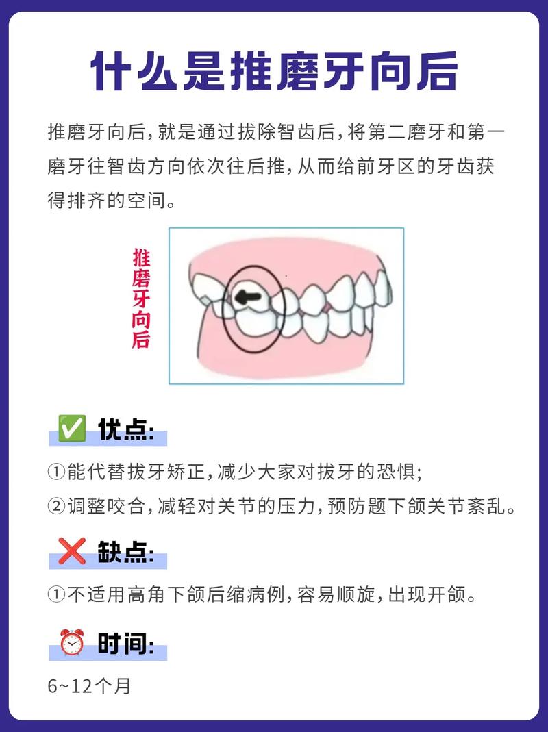 支抗磨牙后移的有效方法有哪些？-图2