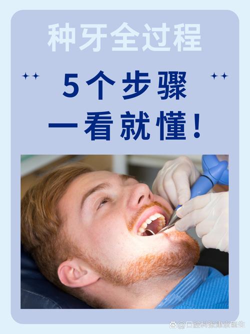 谁在德医口腔种牙？真实效果与体验如何？-图1