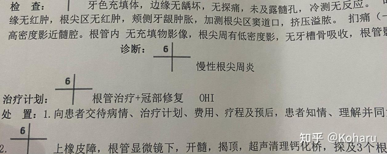 牙髓炎的诊断方法有哪些？这些关键方法你了解吗？-图1
