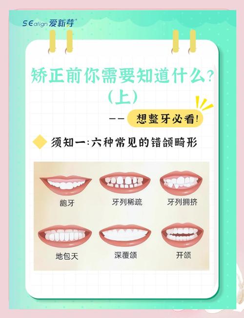 错颌畸形矫正方法如何选择最适合的方案?-图3 错颌畸形矫正方法如何选择最适合的方案?-图3