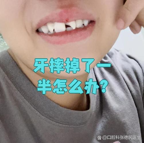 牙根摔掉后，还能通过种植牙修复吗？-图1