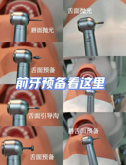 牙科车针如何正确使用？新手必看步骤与注意事项-图1