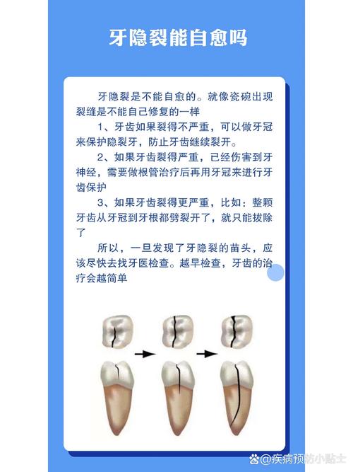 牙裂最佳治疗方法是什么？如何有效修复？-图1