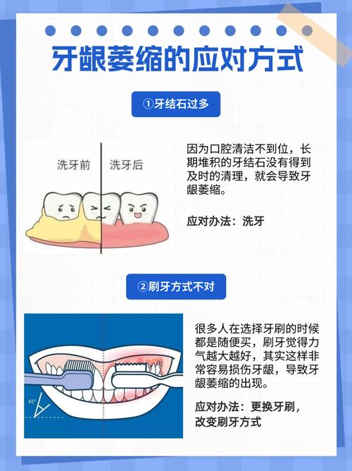 牙龈萎缩手术方法有哪些？如何选择合适方案？-图1