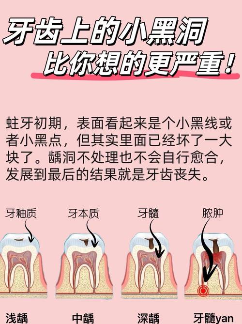 牙齿杀神经的方法具体有哪些操作步骤？-图1
