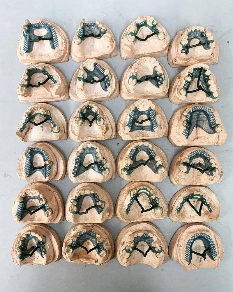 牙科支架制作方法的具体步骤和技术要点是什么？-图1