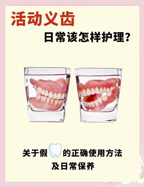 活动义齿摘戴的正确方法有哪些步骤和技巧?-图3 活动义齿摘戴的正确方法有哪些步骤和技巧?-图3