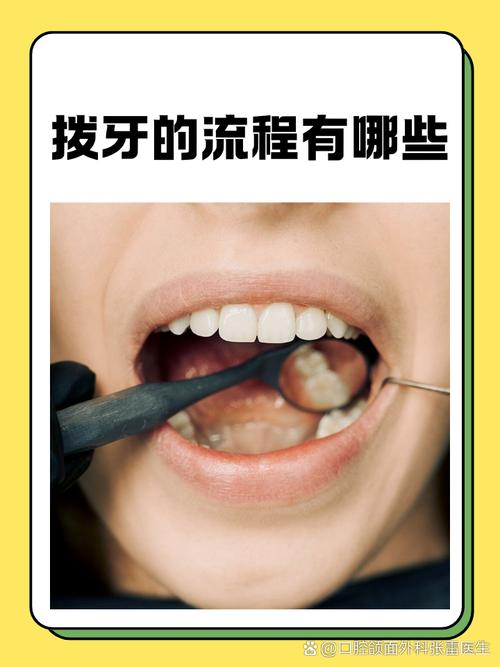 口腔拔牙基本方法有哪些关键步骤？-图1