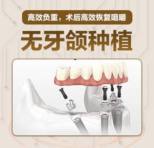数字化种植牙真的比传统种植更靠谱吗？-图2