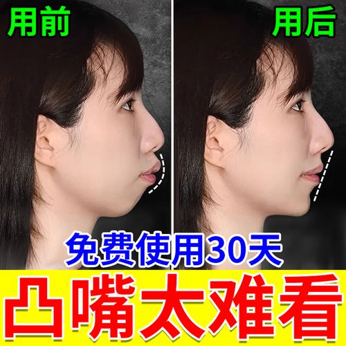 儿童偏颌矫正方法有哪些？如何科学选择？-图3