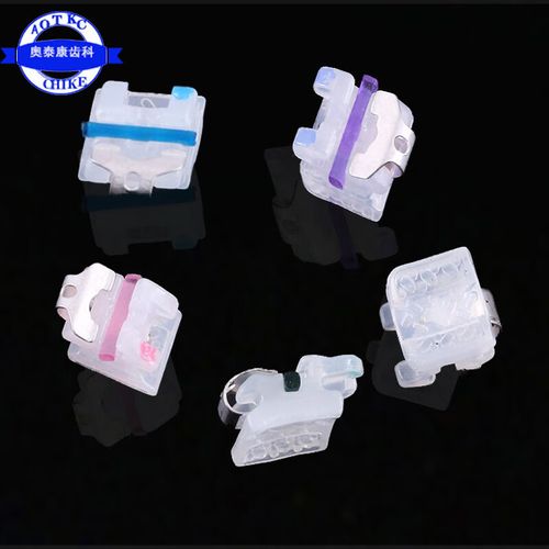 正畸陶瓷托槽为何频繁脱落？原因何在？-图1