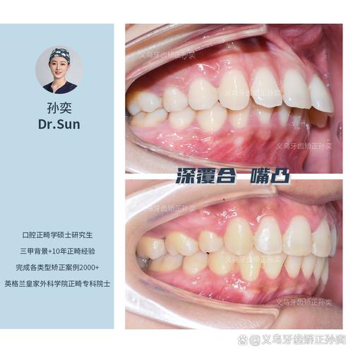 广东正畸医生中的博导有多少位？-图2