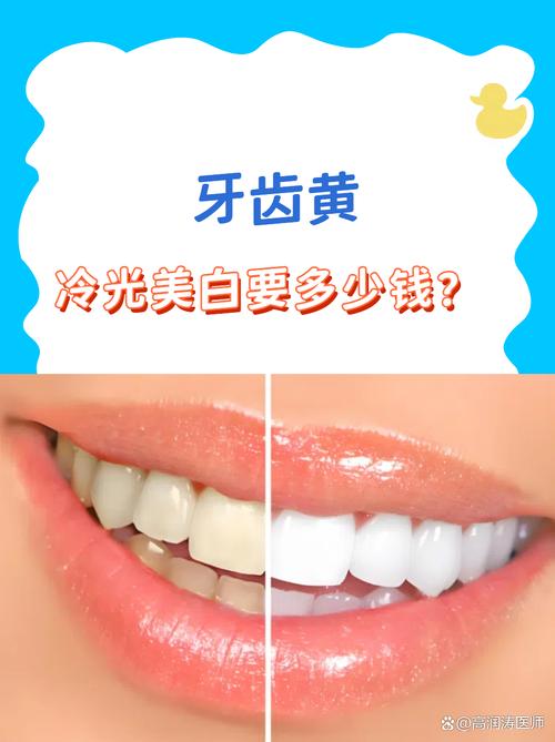 牙齿美白方法价格差异大吗？哪种性价比高？-图3