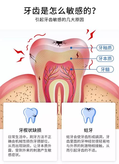 牙脱敏症状如何缓解？有哪些处理方法？-图3