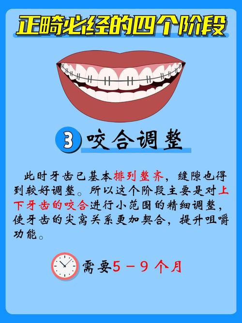 牙齿前翘的治疗方法有哪些？哪种更有效？-图2