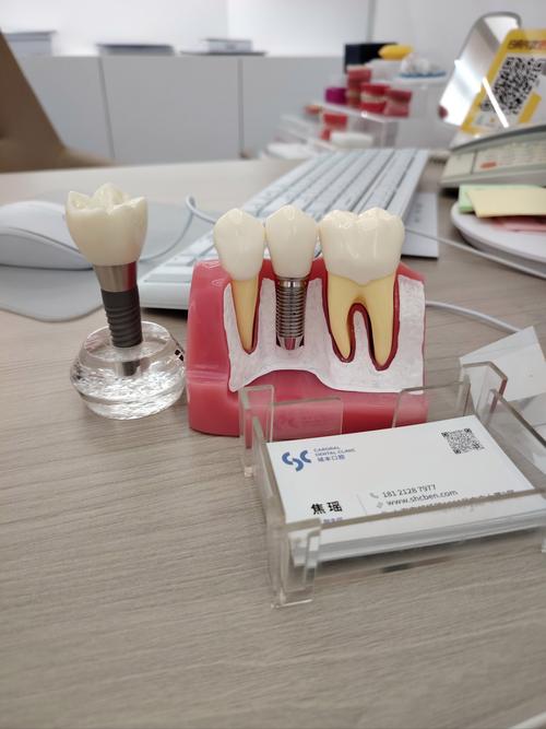 种牙材料用纤维有何新优势？-图1