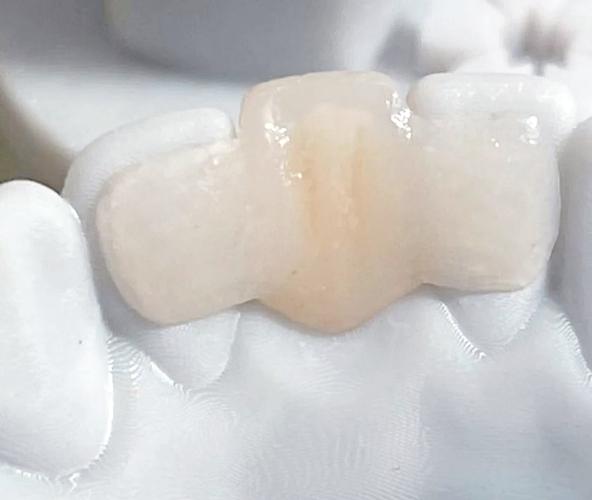 种牙材料用纤维有何新优势？-图3