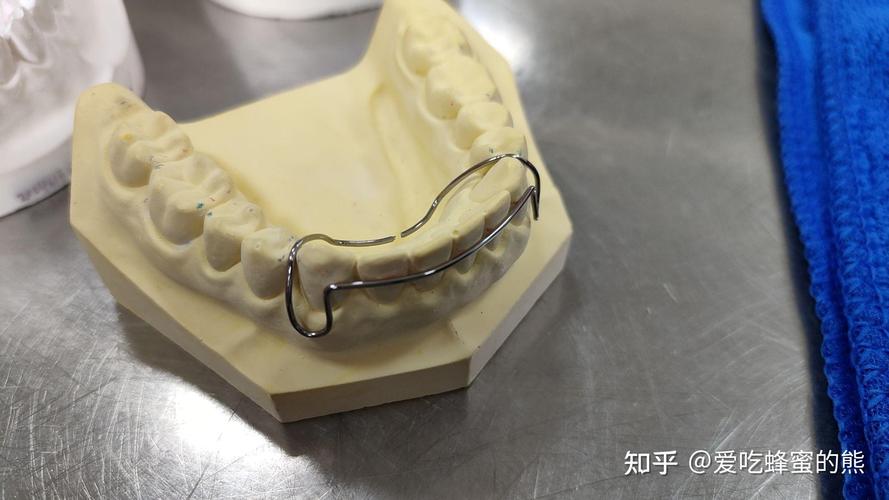 MEAN弓正畸是什么技术？原理和作用有哪些？-图2