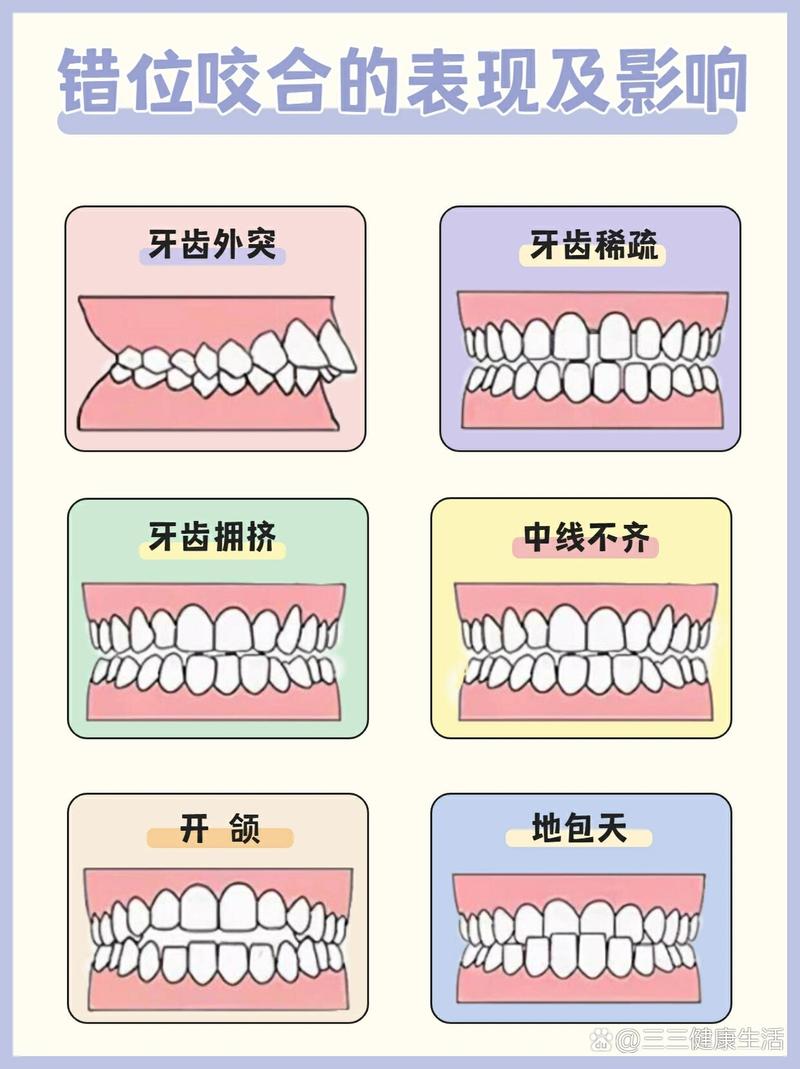 正畸咬合关系分类图片如何区分不同类型？-图3