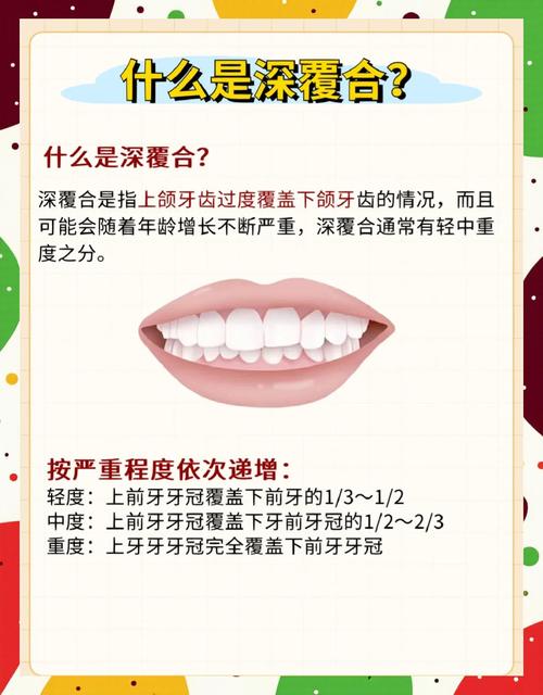 深覆合治疗方法有哪些？如何选择合适方案？-图1