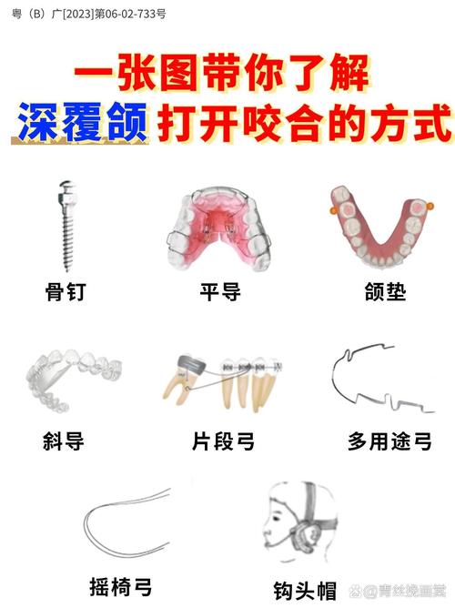 牙齿咬合矫正方法有哪些？如何挑选适合自己的？-图3
