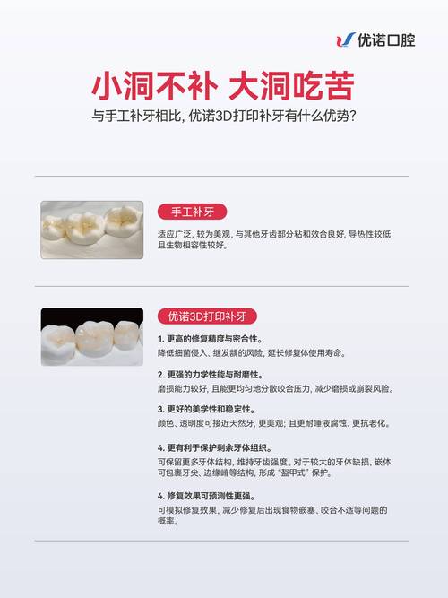 补牙哪种方法最好？不同蛀牙情况如何选对方案？-图3