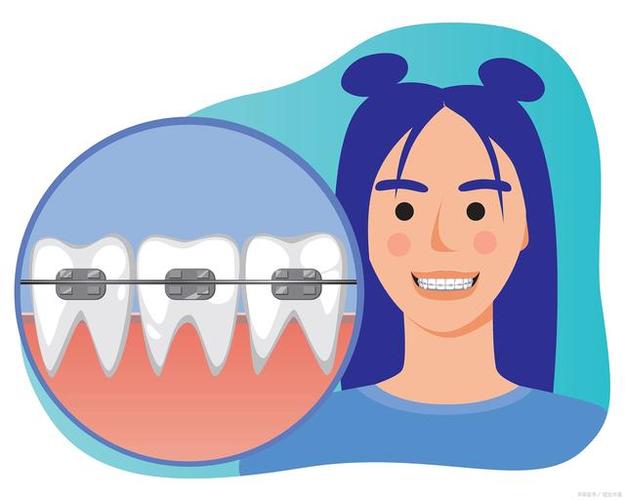 正畸模型分析动画制作如何提升诊疗效率?-图1 正畸模型分析动画制作如何提升诊疗效率?-图1