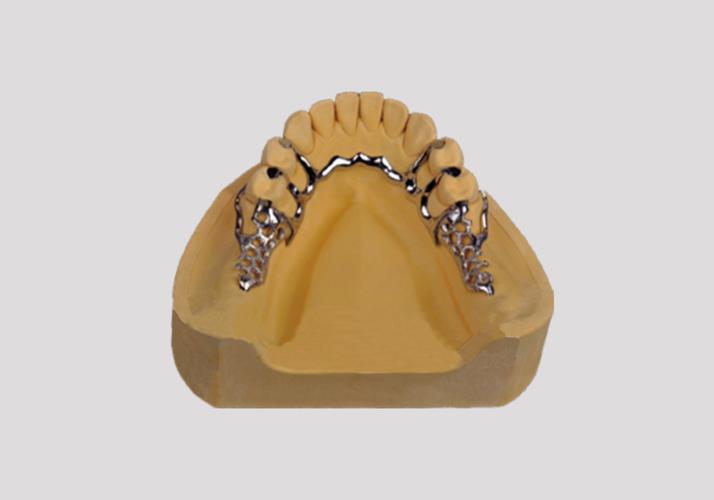 种牙vs活动义齿，到底哪个更适合？-图3