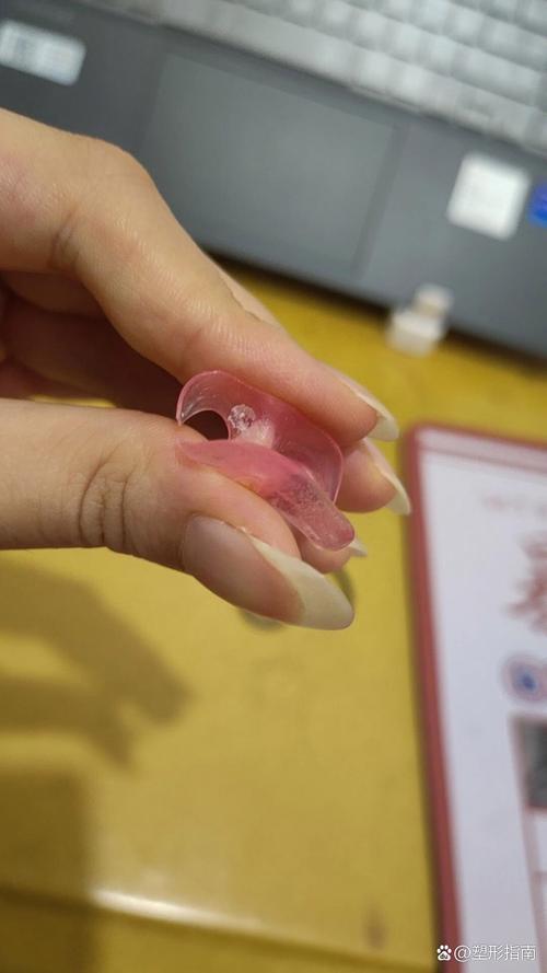 种牙vs活动义齿，到底哪个更适合？-图2