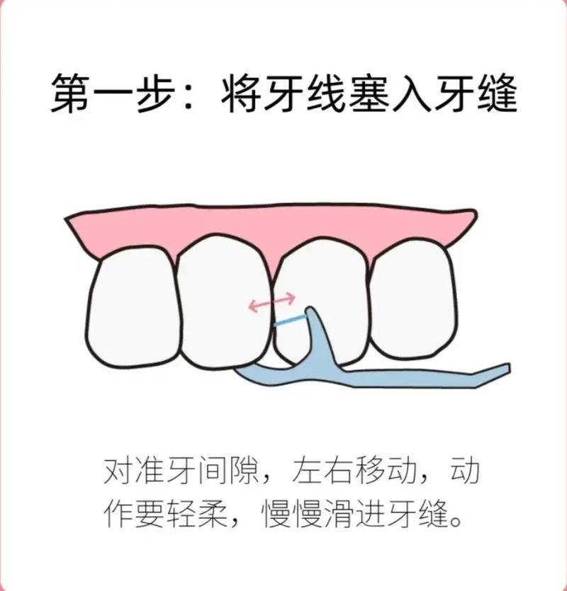 如何正确使用牙线？新手实用方法指南！-图2