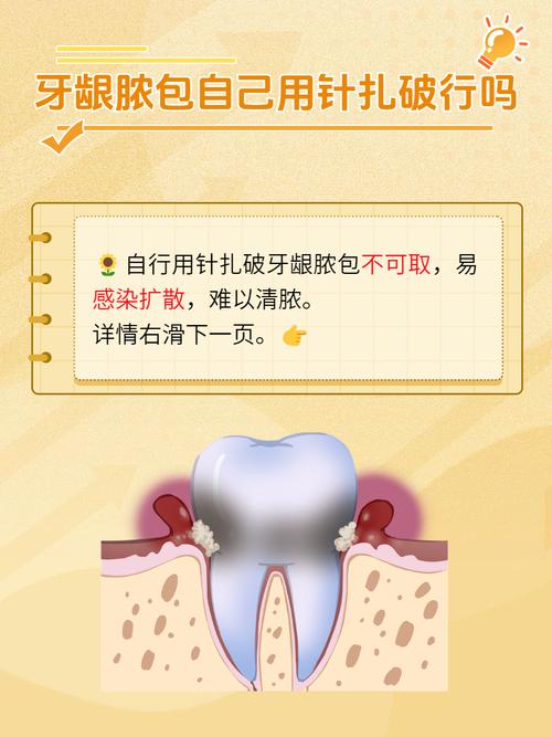 根尖囊肿有哪些有效治疗方法？-图3