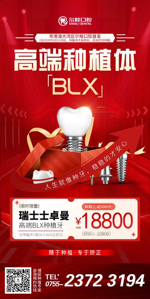 瑞士种牙品牌SG的种植体技术有何过人之处？-图2