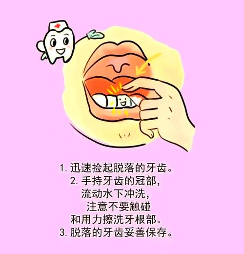 牙外伤的治疗方法有哪些？如何正确选择？-图3