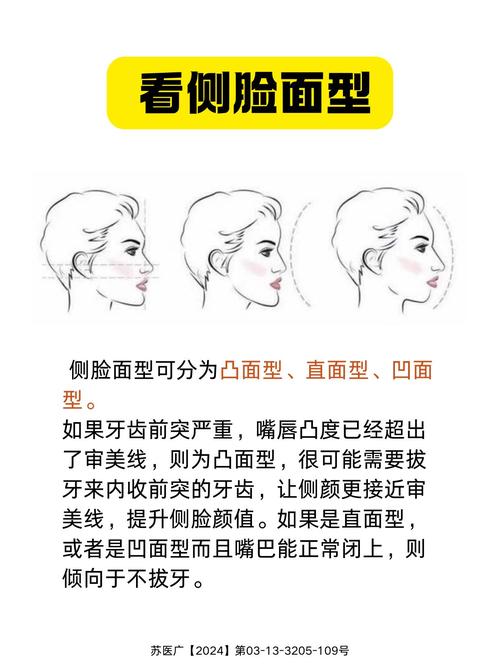 哪些因素影响正畸拔牙矫正的决策？-图3