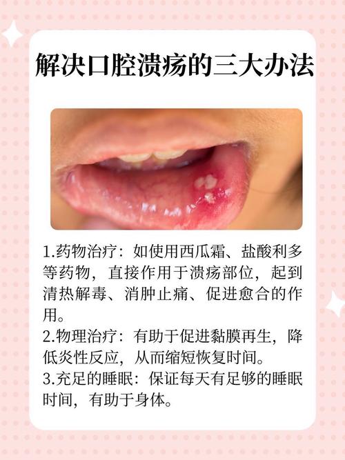 口腔溃疡快速治疗方法有哪些？-图1