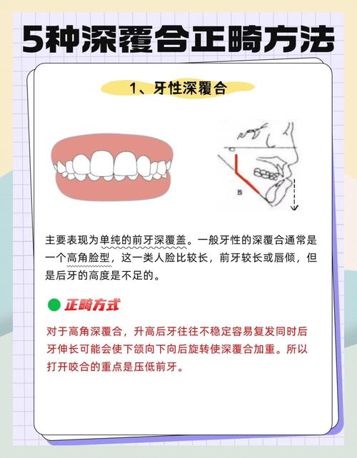 矫正都有哪些方法？不同需求怎么选最合适？-图1