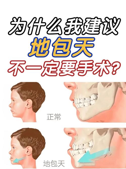 地包天该选正畸还是修复？哪种矫正方案更有效？-图1