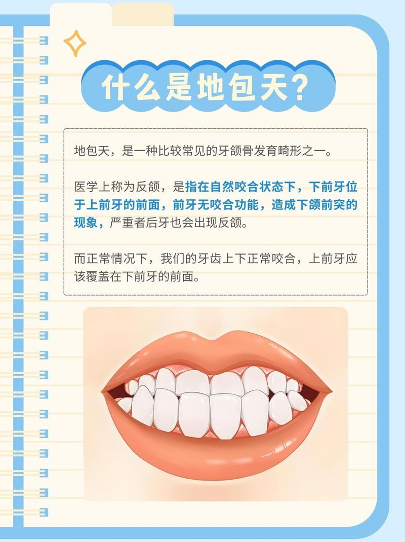 地包天矫正有哪些方法？如何选择合适方式？-图2