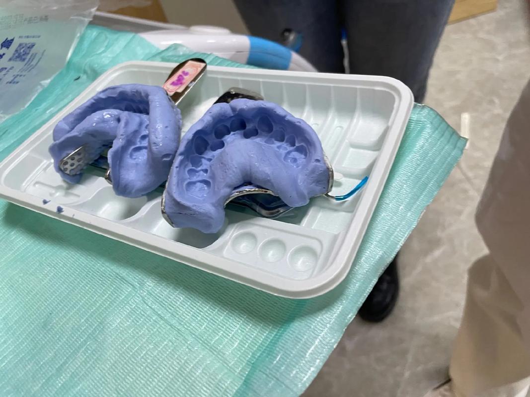 正畸完成后的牙齿模型，该如何处理？-图1