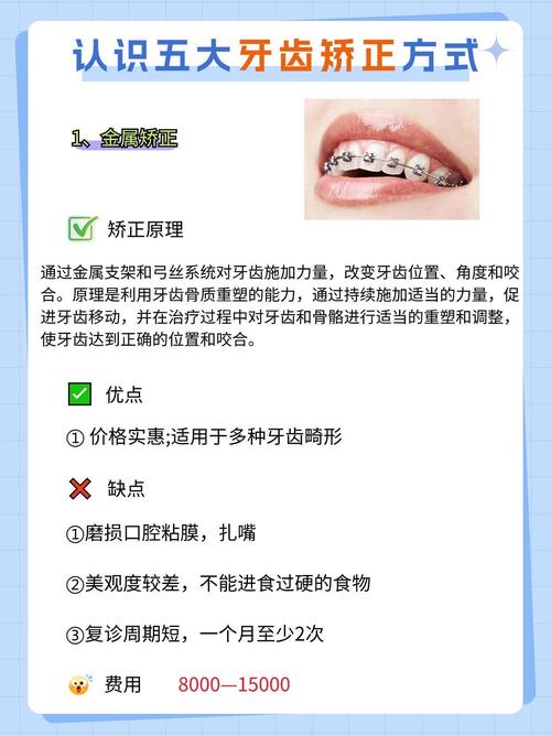 牙齿矫正有几种方法？常见矫正方式大盘点？-图3