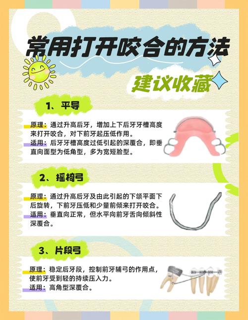 牙齿矫正有几种方法？常见矫正方式大盘点？-图1