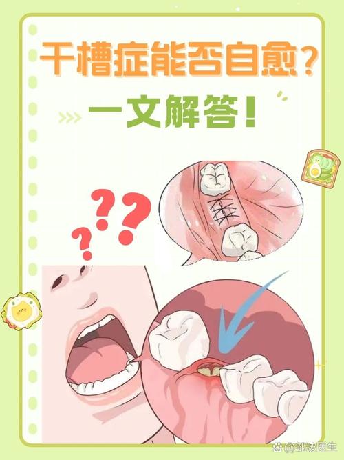 正畸拔牙后干槽症的发生风险高吗？-图1