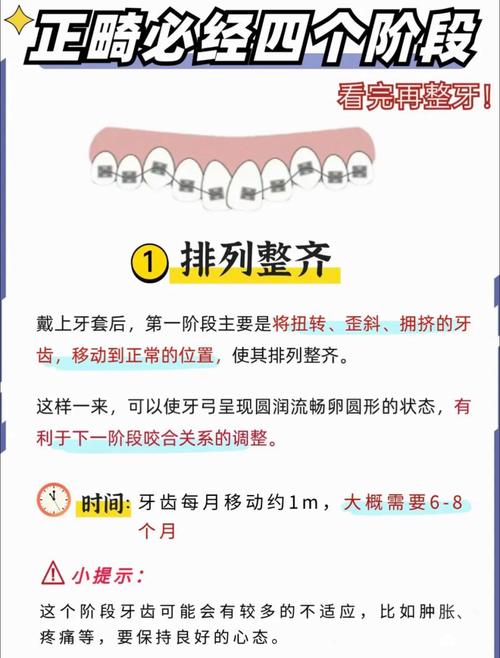 牙周病患者如何选择合适的正畸治疗方法？-图1