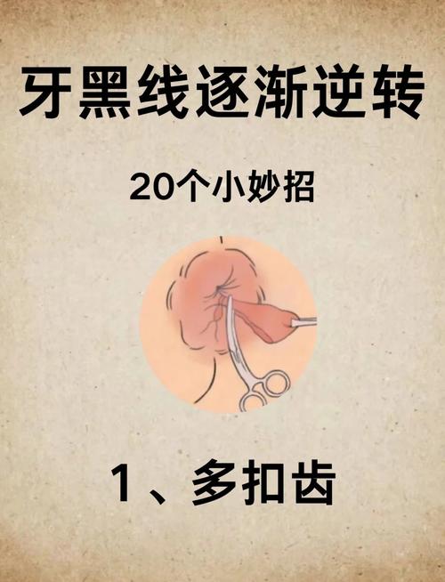 黑牙怎么治？有哪些有效方法？哪种适合你？-图1
