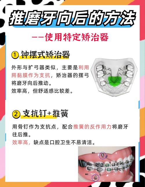 磨牙伸长后如何有效进行正畸修复治疗？-图2