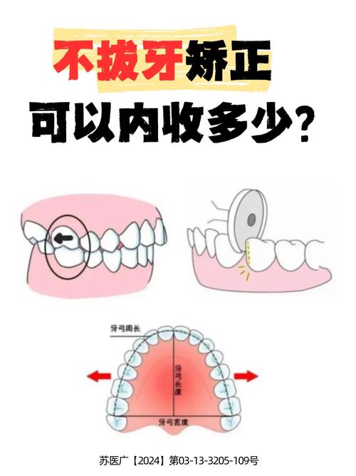 压低下前牙的有效方法有哪些？如何正确操作？-图2