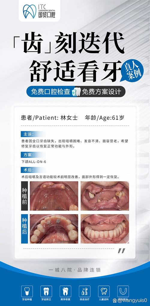 南京种牙成功案例，效果真的有那么好吗？-图3